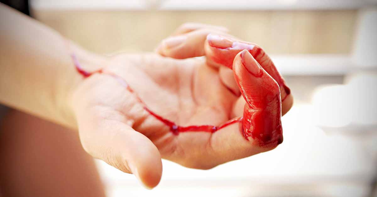 Obdachlose Menschen und Menstruation: Bluten auf der Straße?