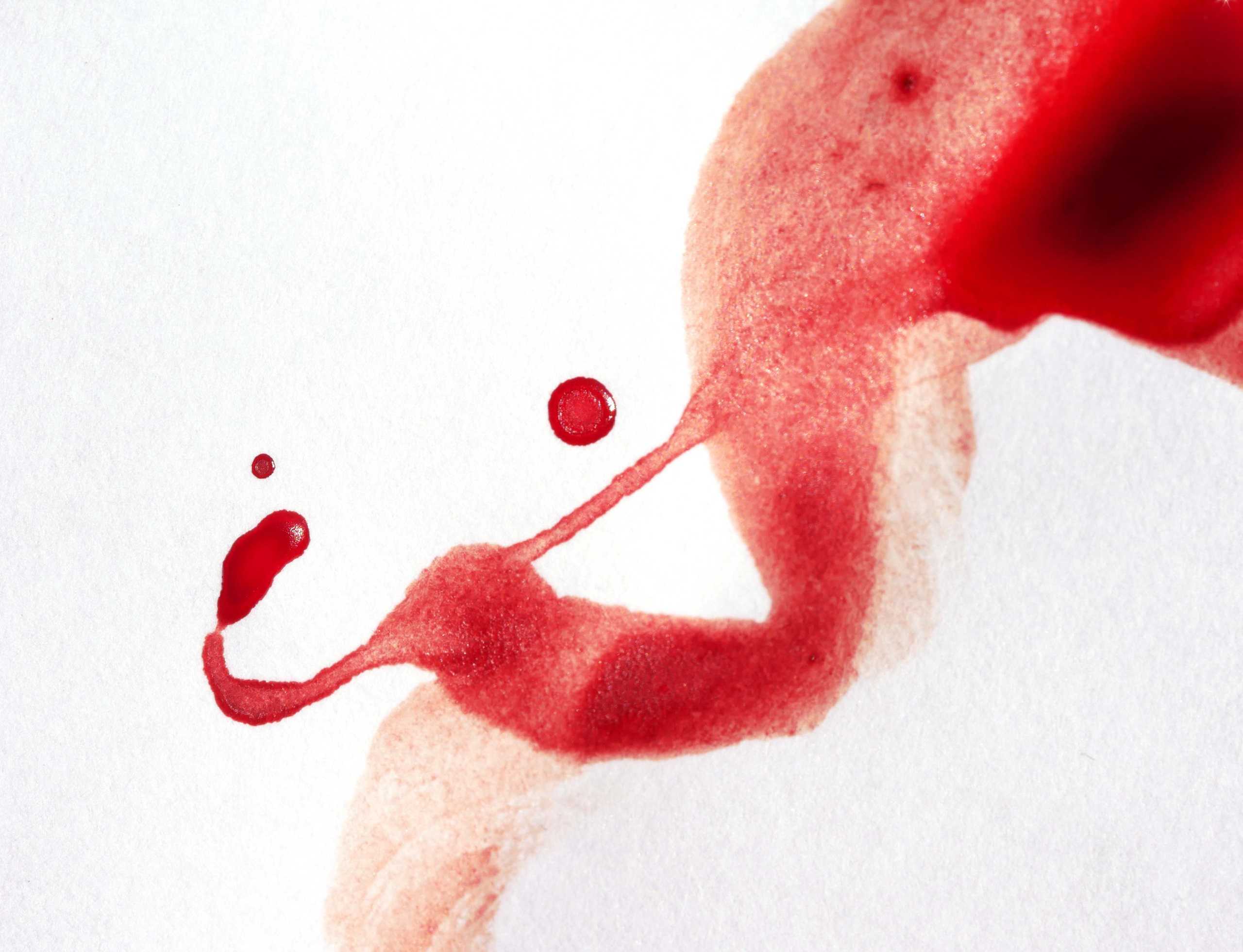When period blood turns into art: A photo gallery